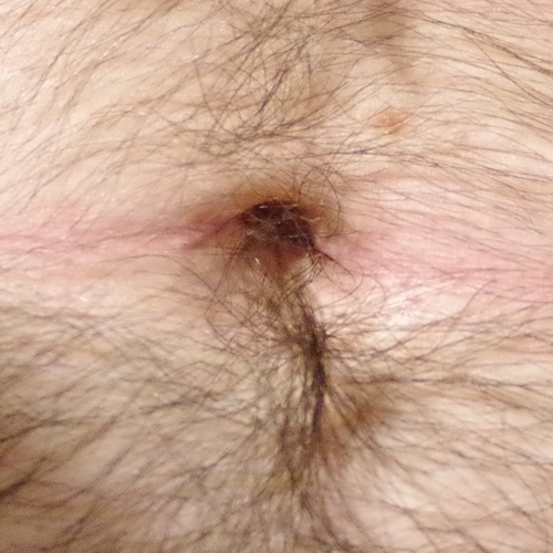 hairy belly button